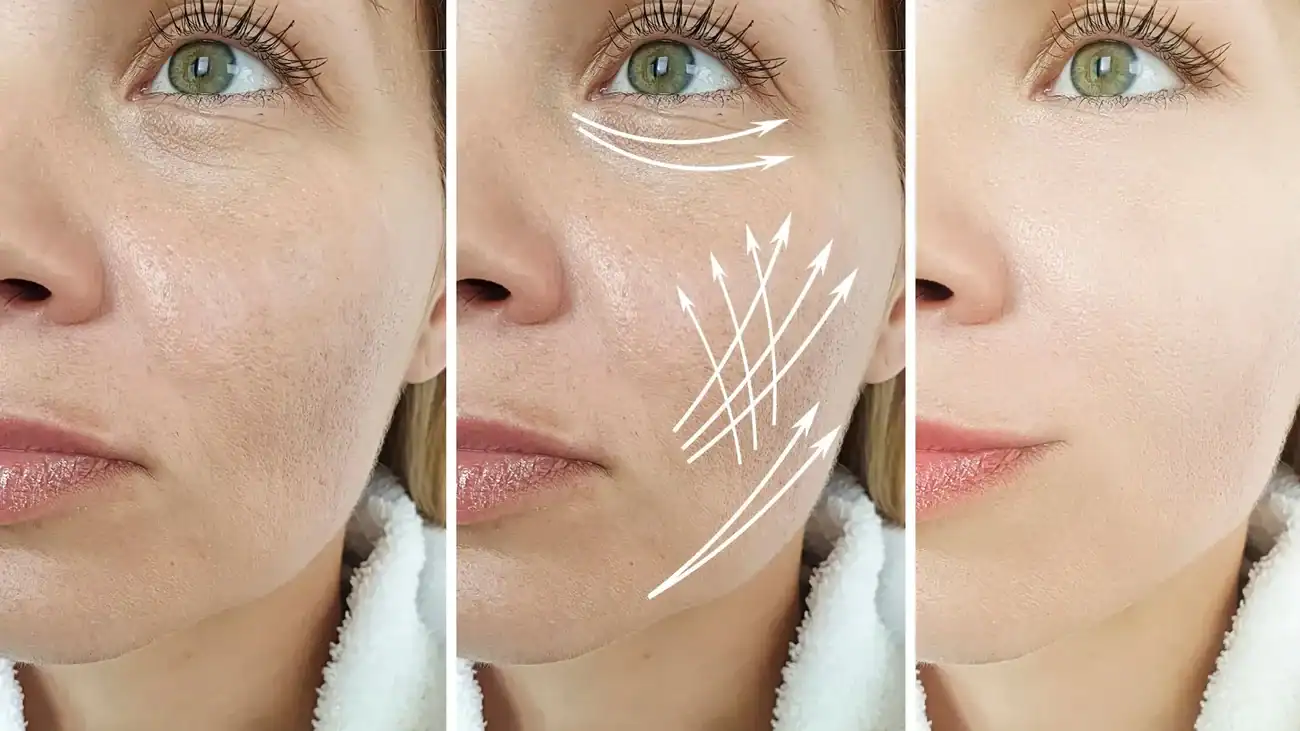 Can One Treatment Really Tackle More Than One Skin Concern Dunmow?