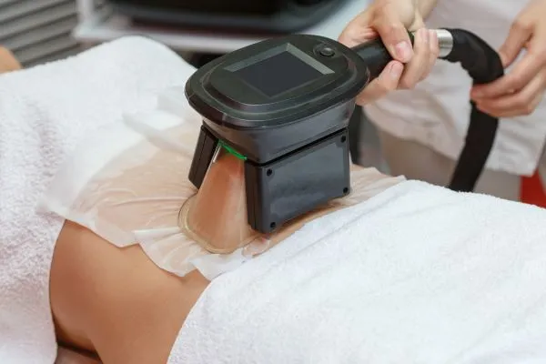 Image of person having fat freezing treatment to help weight gain Dunmow