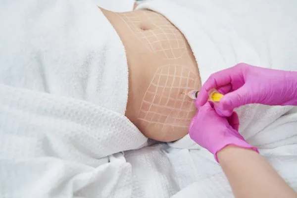image of fat dissolving injections on love handles to help combat weight gain Dunmow