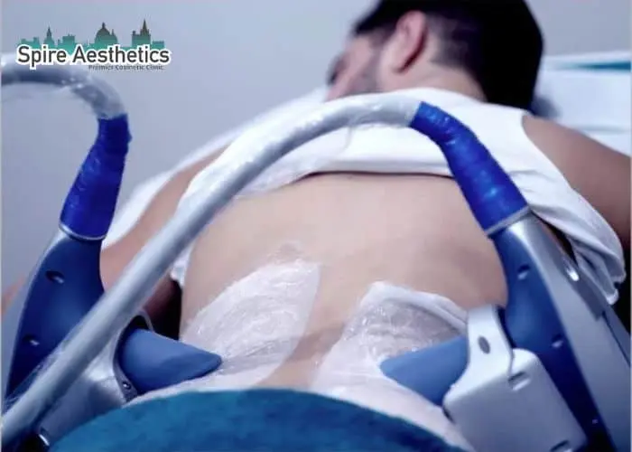 Man having fat freezing treatment done on love handles before a competitions Dunmow to create a sculpted look.