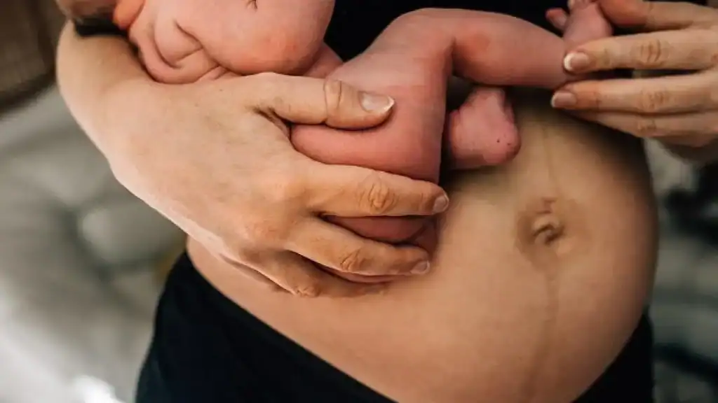 Why Is My Stomach Still Big After Pregnancy Dunmow?